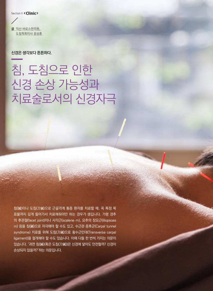 신경은 생각보다 튼튼하다... 이미지