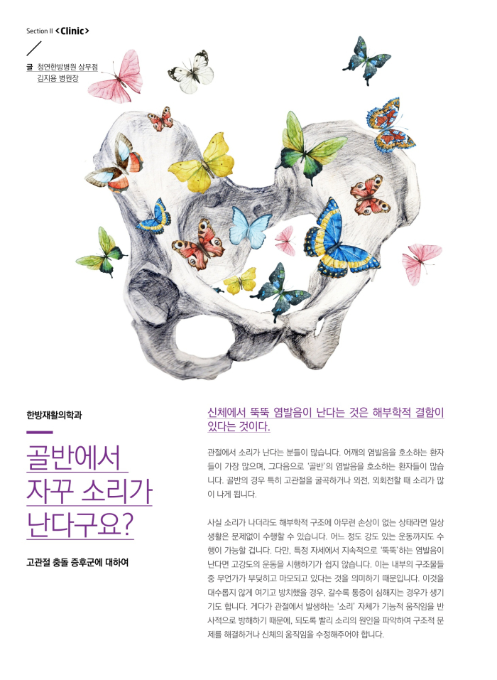 고관절 충돌 증후군에 대... 이미지