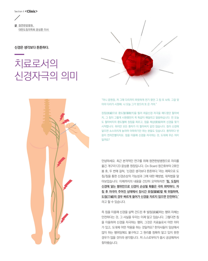 신경은 생각보다 튼튼하다... 이미지