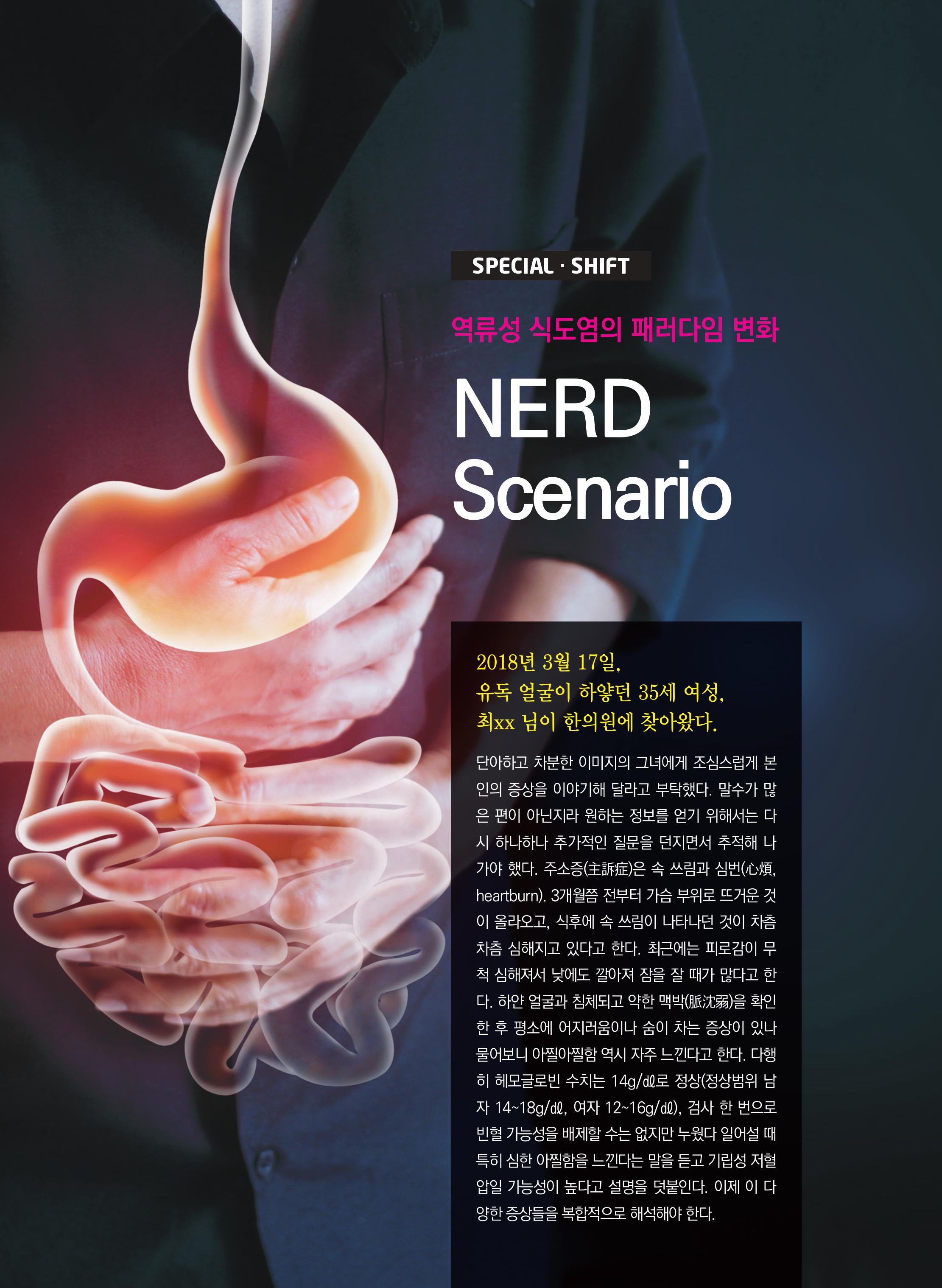 NERD Scenario 이미지